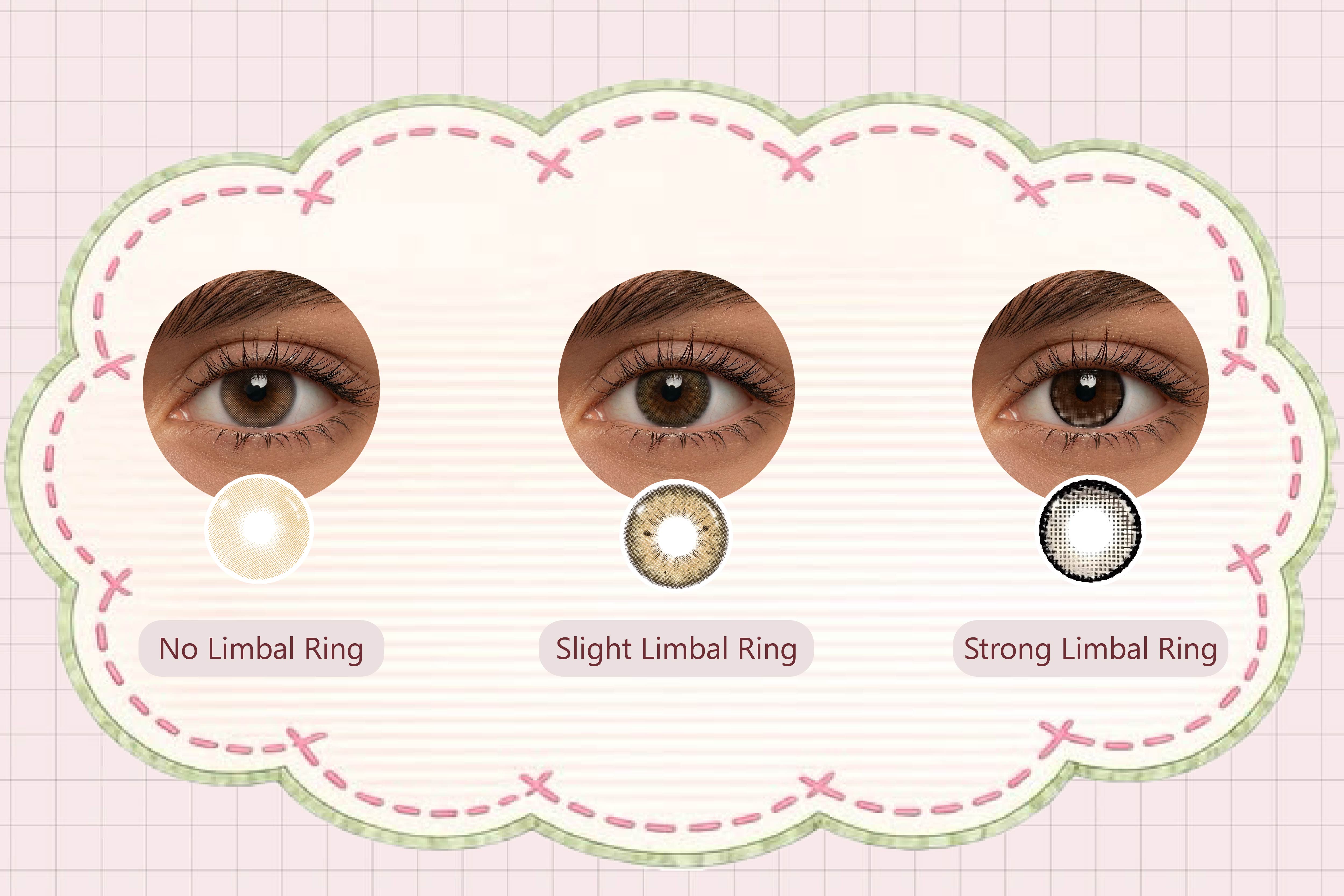 What Is a Limbal Ring in Colored Contacts?