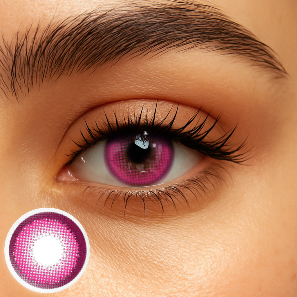 Rosie Berry (1-Year)