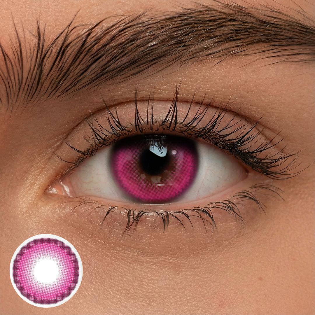 Rosie Berry (1-Year)